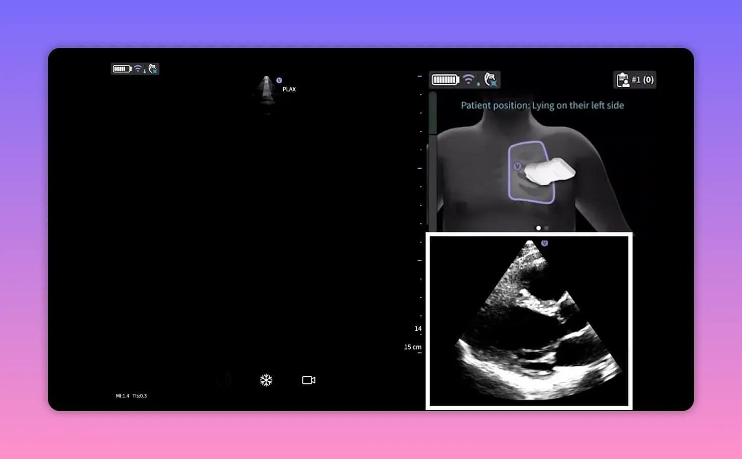 Vscan Air SL: Cardiac Guidance und AutoEF im Herzultraschall verstehen 3 Benutzeroberfläche mit Körperdiagramm zur Sondenposition und Referenzbild einer Herzansicht
