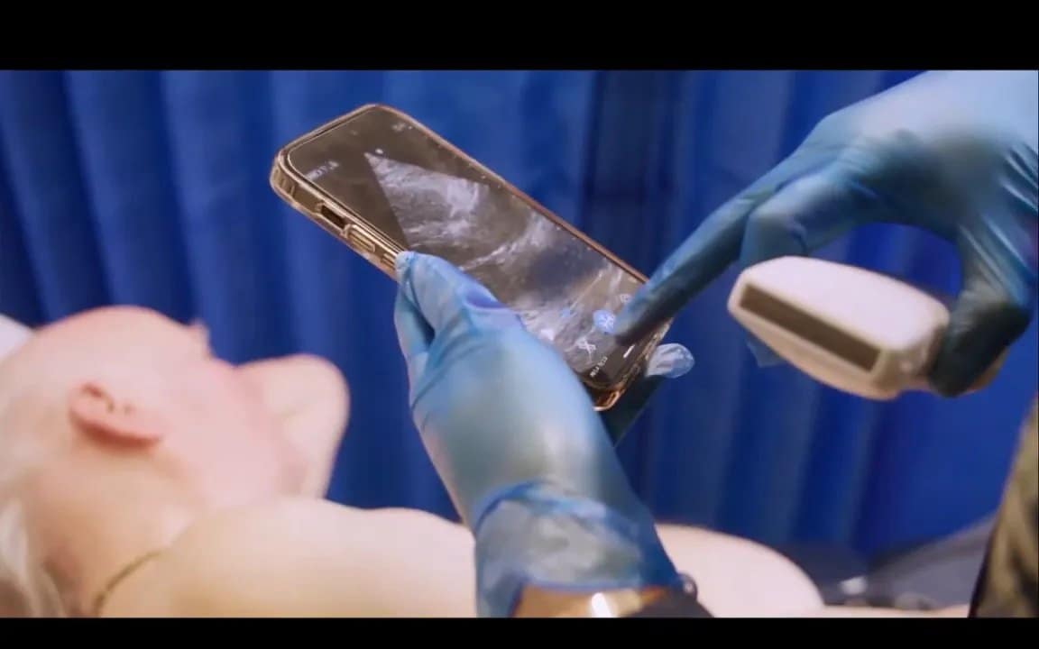 Vscan Air Erfahrungen in UK: Wie Handheld-Ultraschall Herzprobleme früh erkennt 4 Smartphone mit klarem Ultraschallbild des Herzens, daneben die Hand eines Untersuchers mit Handheld-Sonde; Patient im Hintergrund