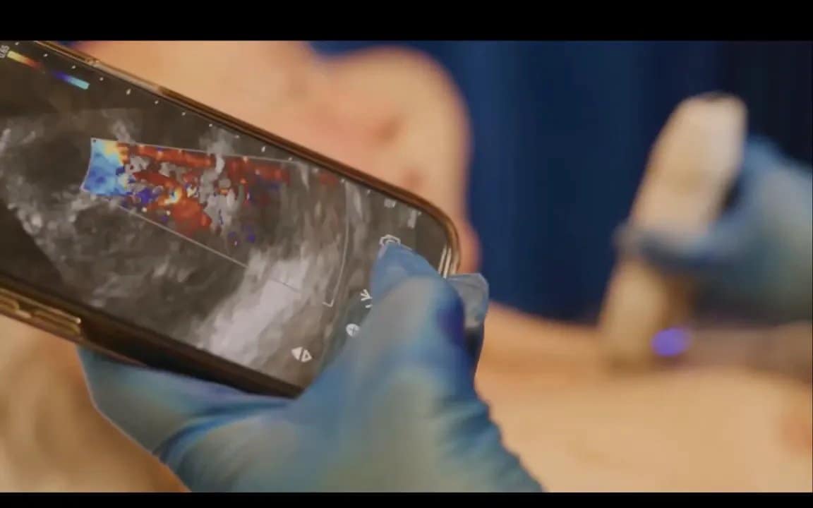 Vscan Air Erfahrungen in UK: Wie Handheld-Ultraschall Herzprobleme früh erkennt 2 Smartphone‑ähnliches Gerät zeigt Farbdoppler‑Ultraschallbild, Hand mit Handschuh bedient das Gerät