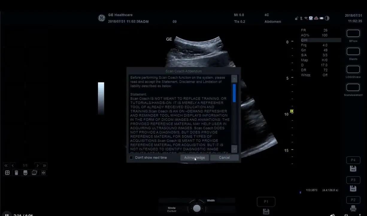Scan Coach am Versana Premier: Einrichtung, Anwendung und eigene Protokolle Schritt für Schritt 5 Hinweisfenster mit Haftungsausschluss für Scan Coach auf dem Versana Premier während der Aktivierung