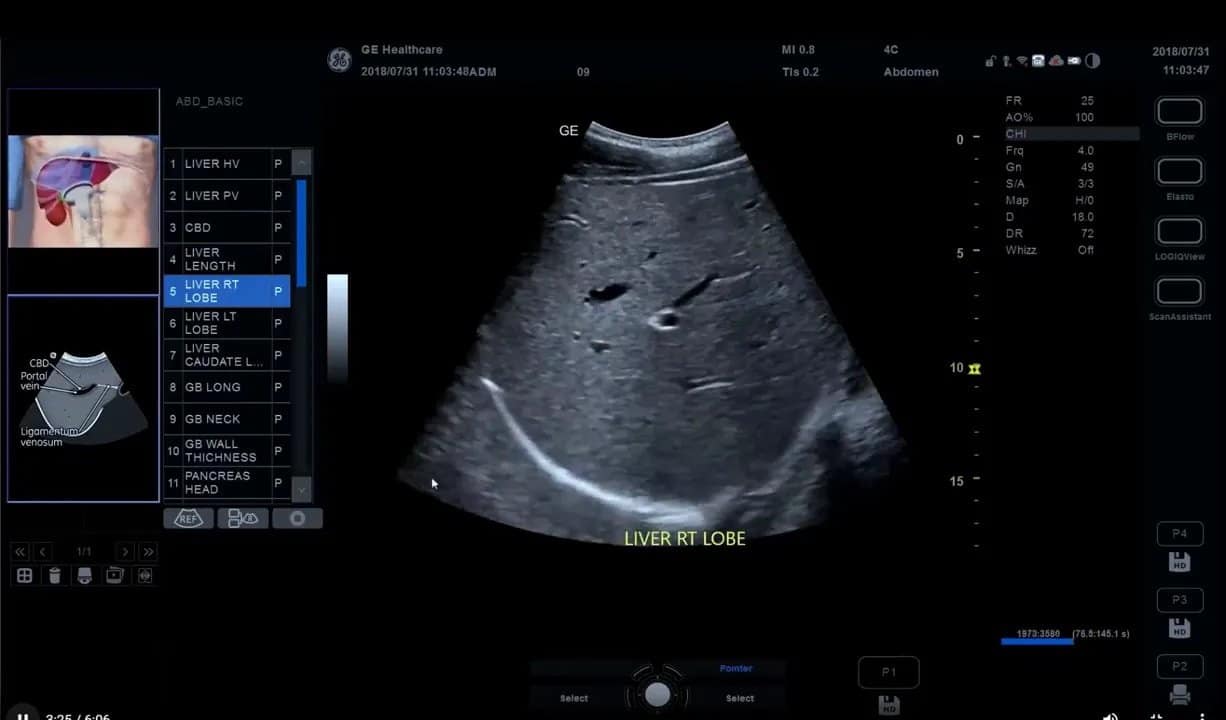 Scan Coach am Versana Premier: Einrichtung, Anwendung und eigene Protokolle Schritt für Schritt 8 Deutlich sichtbare Scan-Coach Protokollschritte am Touchpanel und Ultraschallansicht vor dem Speichern