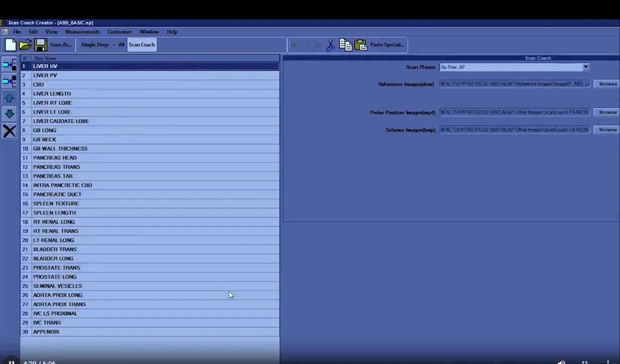 Scan Coach am Versana Premier: Einrichtung, Anwendung und eigene Protokolle Schritt für Schritt 11 ScanCoach Creator am Versana Premier: Protokollschritte mit Referenzbildfeldern und Auswahlbereichen für DCM-Referenzinhalte