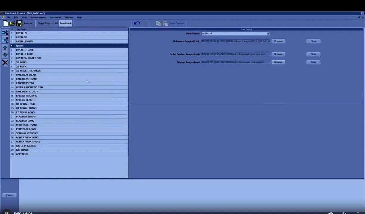 Scan Coach am Versana Premier: Einrichtung, Anwendung und eigene Protokolle Schritt für Schritt 14 ScanCoach Creator auf dem Versana Premier zum Import und Zuweisen von Referenzbildern in Scan Coach