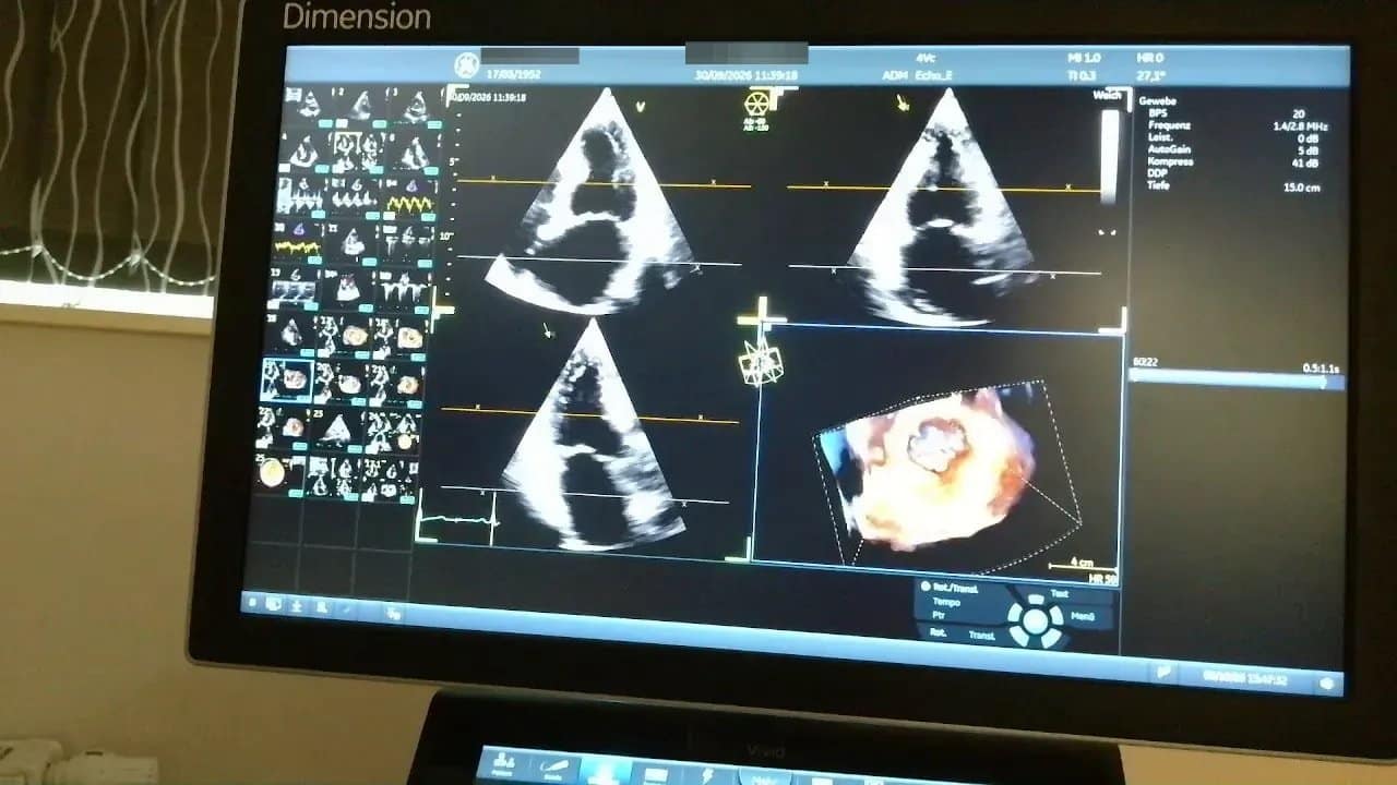 Vivid 4D: Ein Praxisbeispiel 3 Ultraschallmonitor mit Schnittbildern und flach angeschnittener räumlicher Darstellung