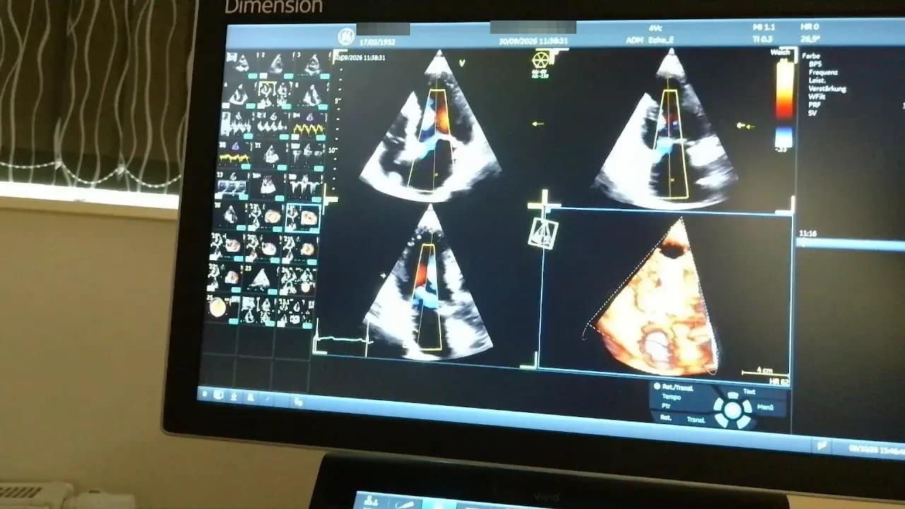 Vivid 4D: Ein Praxisbeispiel 4 Ultraschallmonitor mit Farbsignalen in den Schnittbildern und einer räumlichen Darstellung