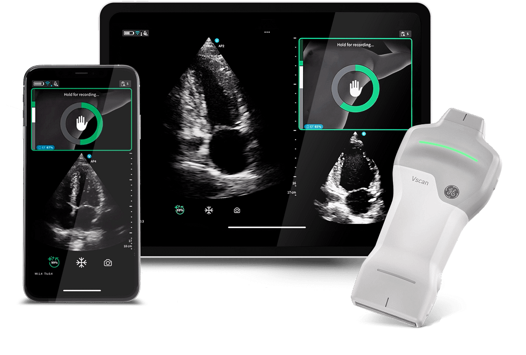 Vscan Air 3 Vscan Air SL mit Caption AI von GE Healthcare
