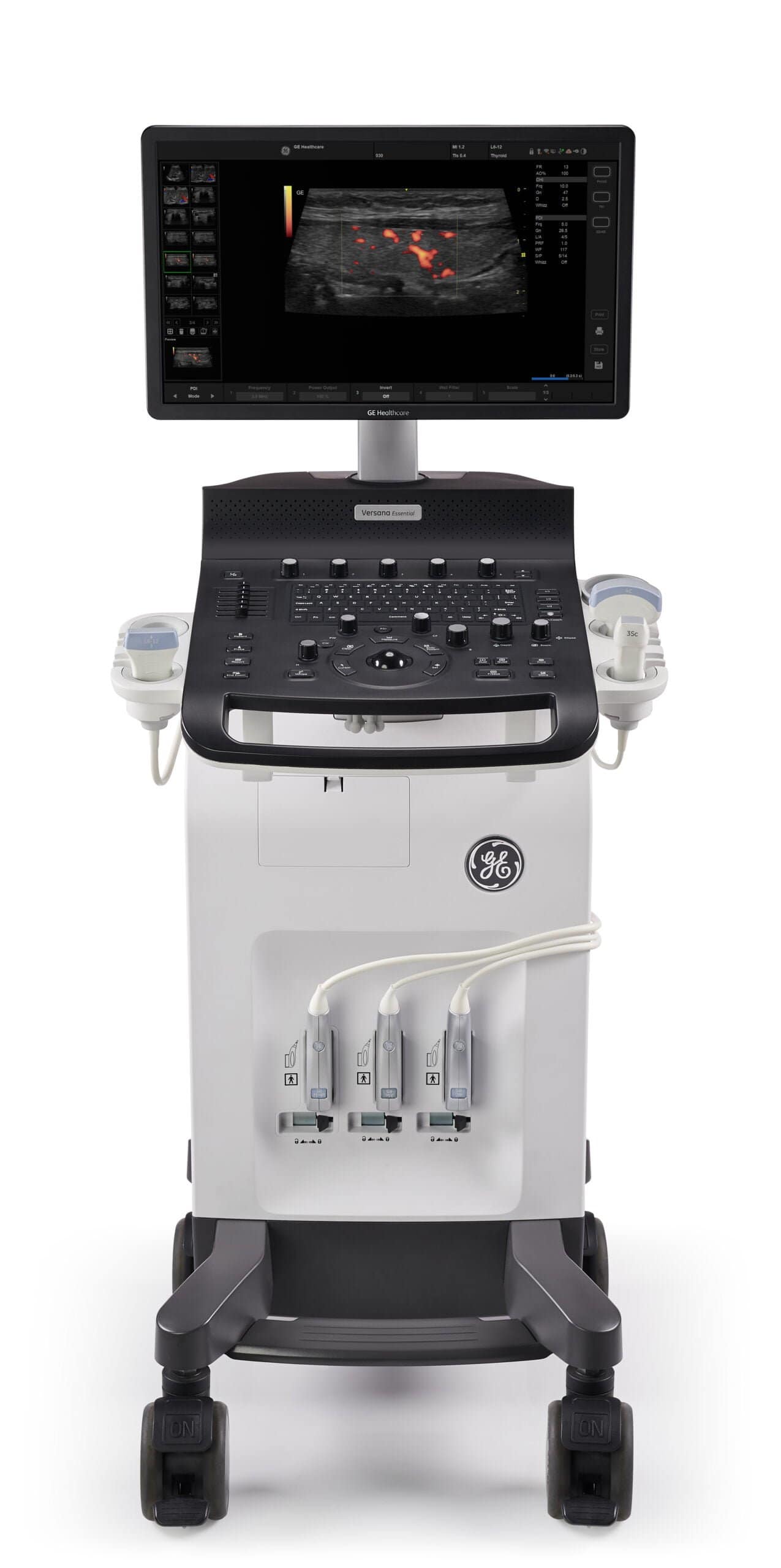 Versana Ultraschallgeräte 3 Versana Active von GE Healthcare