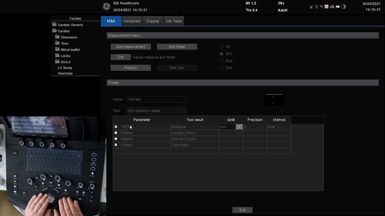 TAPSE Messung am Versana 6 Ultraschallgerät Bildschirm: Messmenü mit TAPSE Eintrag, M-Mode ausgewählt und Einheit mm.