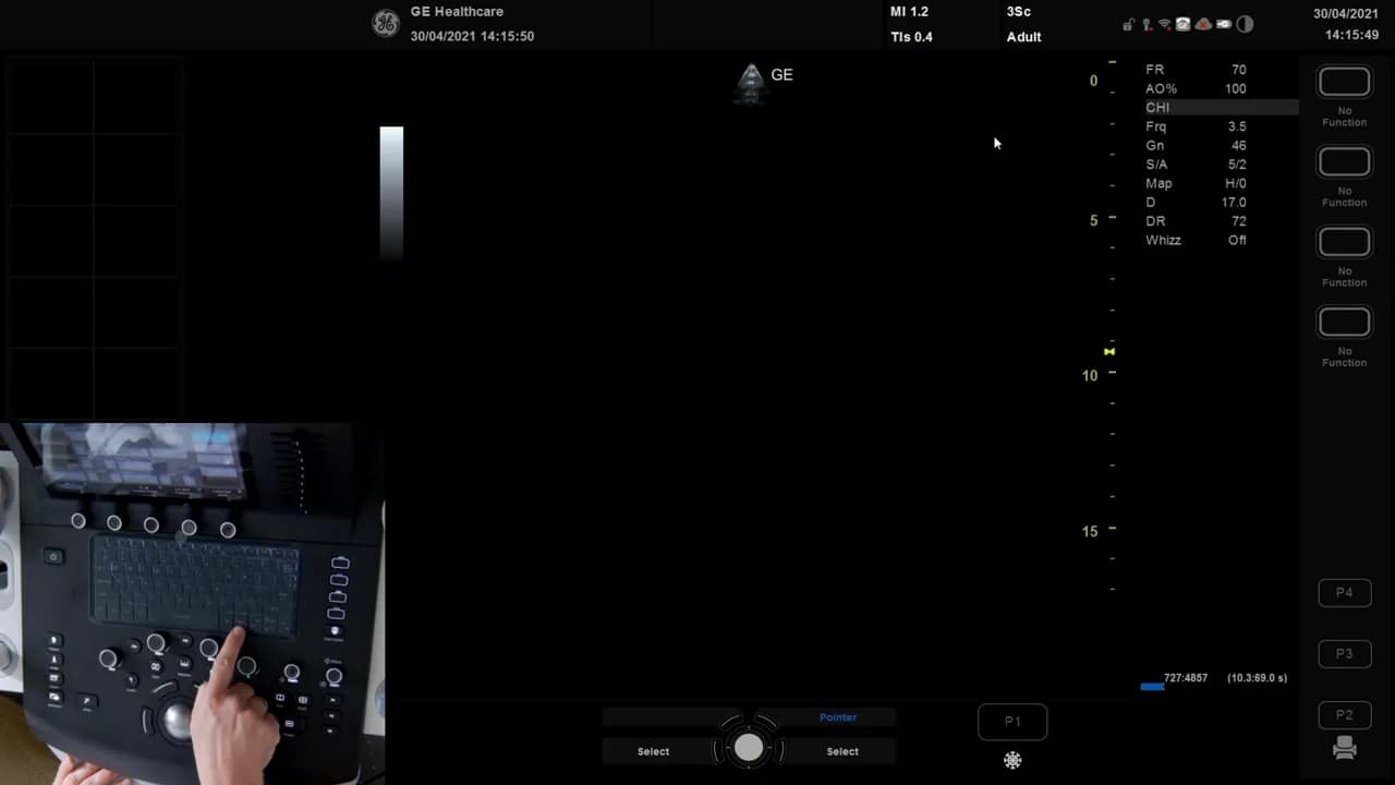 TAPSE Messung am Versana 2 Hand zeigt auf Tastaturbedienelemente der Vesana‑Ultraschallkonsole; Finger deutet auf Preset/Bedienfeld.