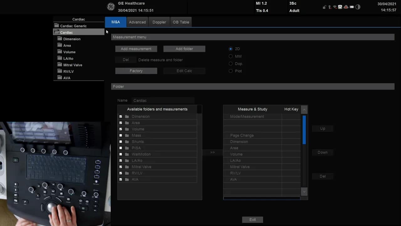 TAPSE Messung am Versana 3 Vesana Ultraschallbildschirm: Measurement-Menü geöffnet mit Schaltflächen 'Add measurement' und Listen für Messkategorien.