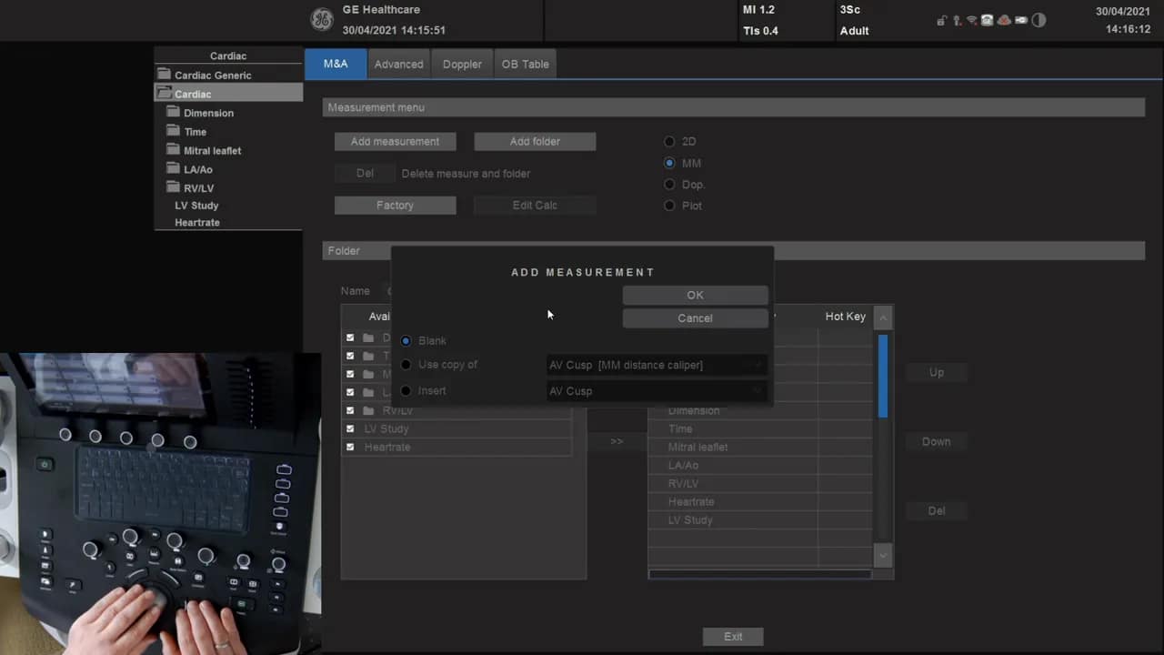 TAPSE Messung am Versana 4 Vesana Bildschirm mit geöffnetem Add Measurement Dialog und der Option Blank ausgewählt