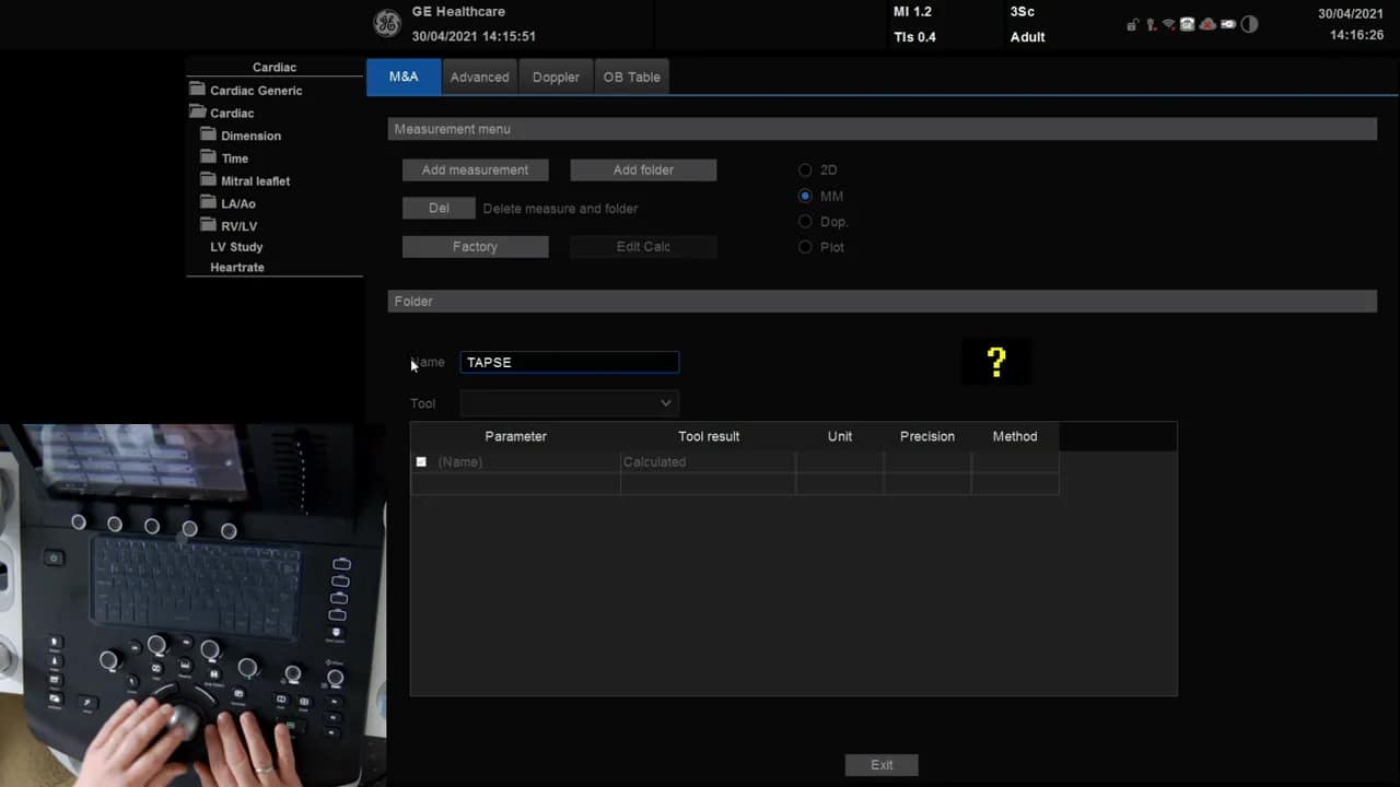TAPSE Messung am Versana 5 Vesana Messmenü mit Namensfeld 'TAPSE' und M-Mode-Auswahl