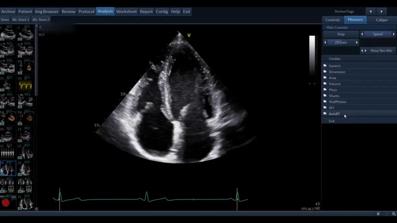 Apikale Vierkammeransicht mit hervorgehobener AutoEF‑Option im rechten Men&uuml;