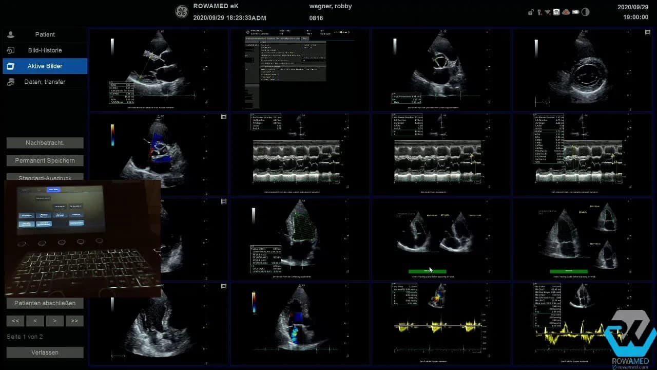 Gespeicherte 2D- und Dopplerbilder der transthorakalen Echokardiographie im Dokumentationsfenster