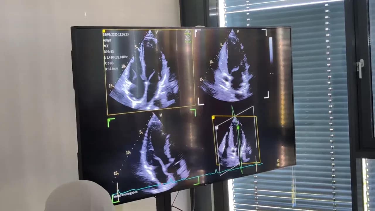 Vivid 4D: Schritt für Schritt von der Bildaufnahme zur kontrollierten Herzanalyse 2 triplane herzansichten - rowamed.com