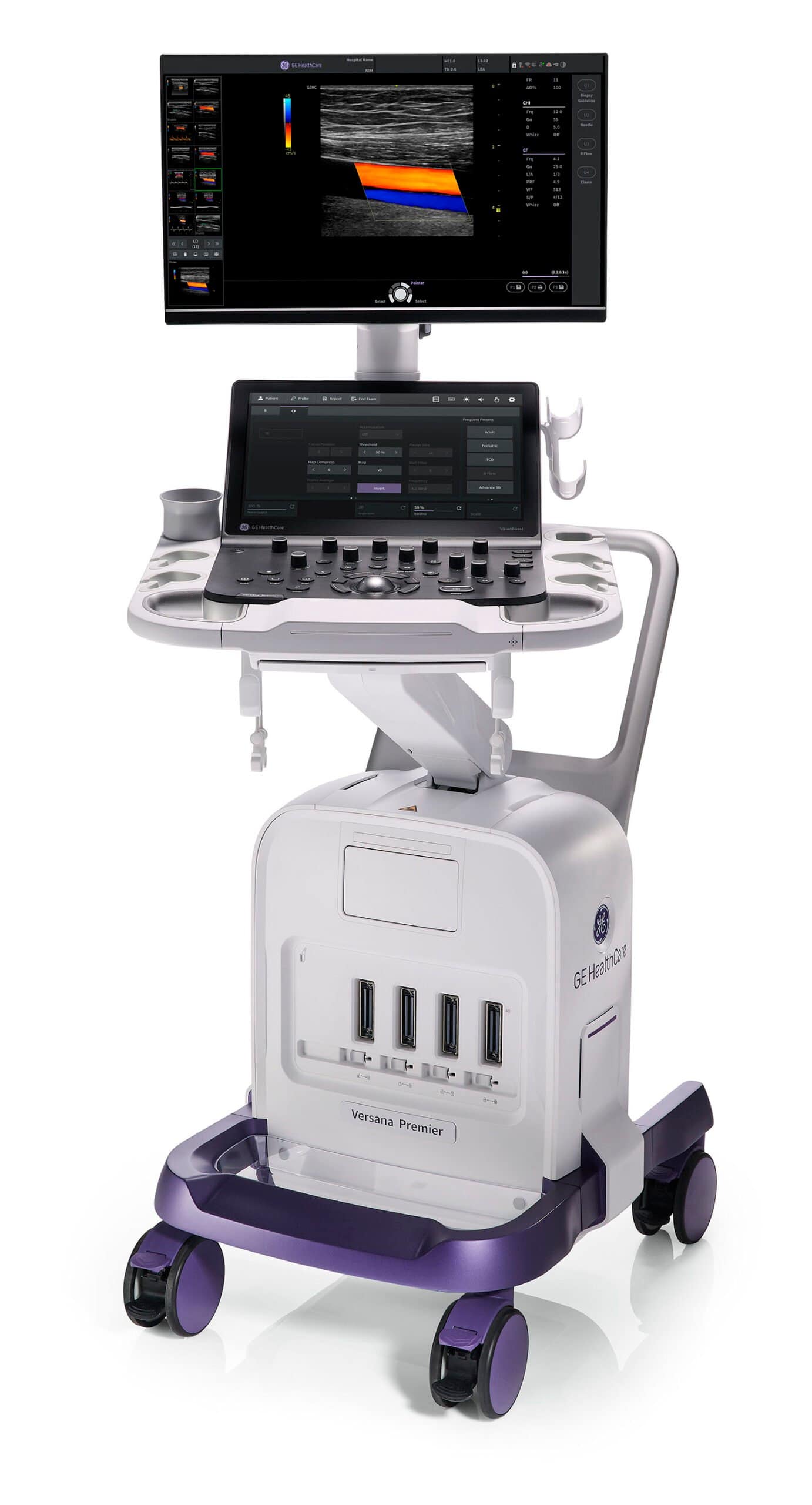 Versana Ultraschallgeräte 5 Versana Premier von GE Healthcare