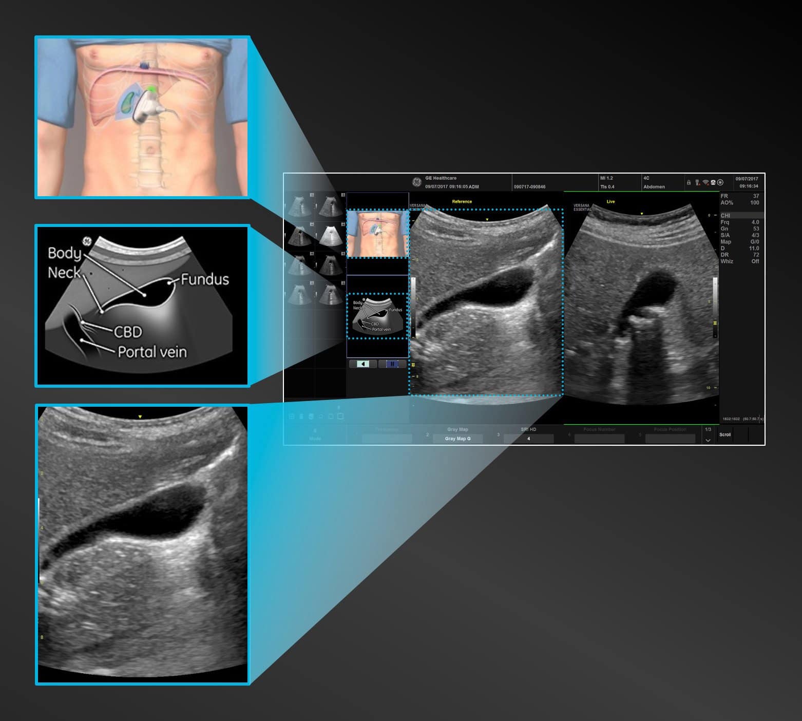 Scan Coach am Versana Premier: Einrichtung, Anwendung und eigene Protokolle Schritt für Schritt 1 Scan Coach von GE Healthcare / ROWAMED
