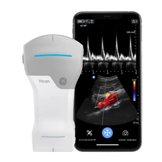 Vscan Air 1 Vscan Air CL von GE Healthcare