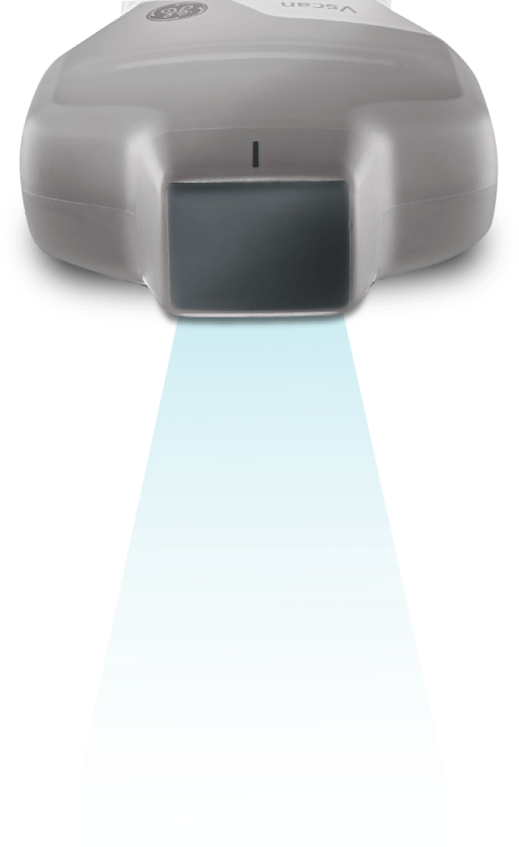 Produktupdate zum neuen mobilen Ultraschallgerät Vscan Air SL mit Sektor UND Linearsonde 3 Der Vscan Air CL besitzt eine Linear- und Convexsonde, der Vscan Air SL eine Linear- und Sektorsonde.