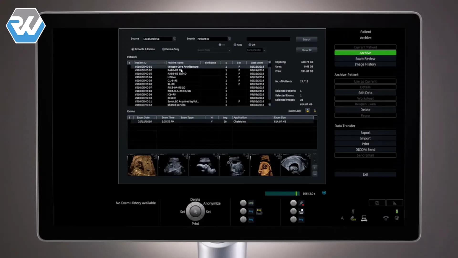 Voluson S8 Touch bedienen: Anleitung in 15 Schritten 25 Archivierung von Bildern